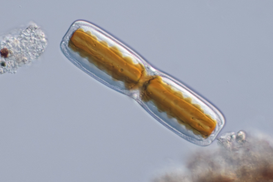 Diatomée marine (algue unicellulaire) x200